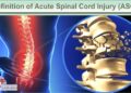 Acute Spinal Cord Injury Treatment: A Bridge to Recovery