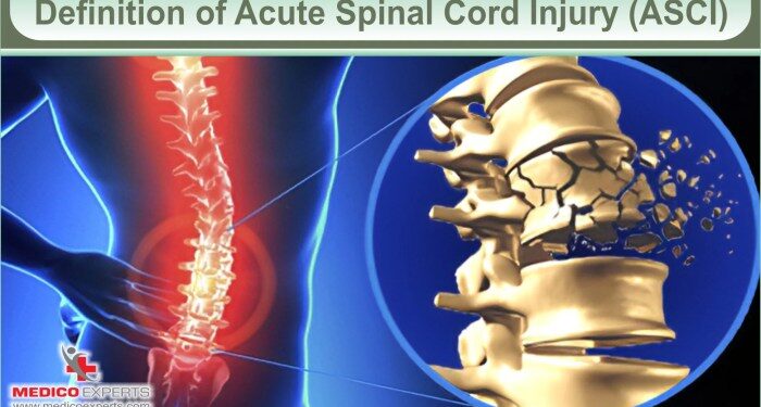 Acute Spinal Cord Injury Treatment: A Bridge to Recovery