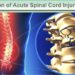 Acute Spinal Cord Injury Treatment: A Bridge to Recovery