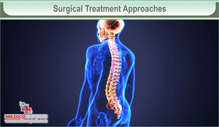 Expertise in Advanced Spinal Surgery by Mr. Irfan Malik | Specialized ...