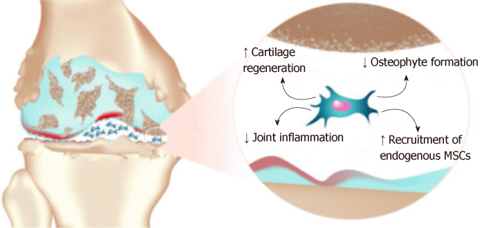 Application of mesenchymal stem cell therapy for the treatment of ...